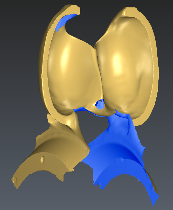 Alignement-Meshed (1).PNG