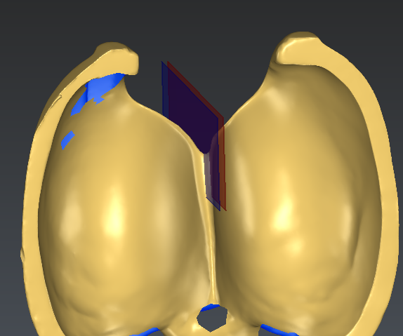 SymmetricPlane.PNG