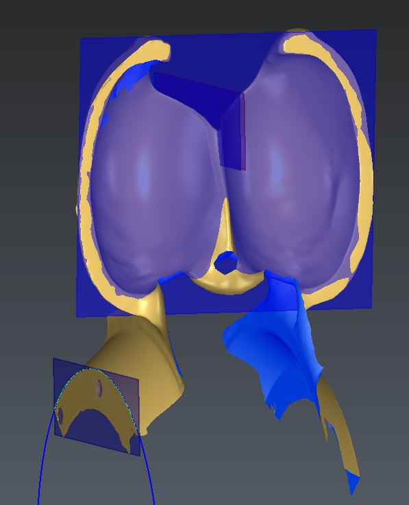 YAxis.PNG